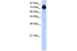 WB Suggested Anti-ZNF16 Antibody Titration:  0. (ZNF16 Antikörper  (N-Term))