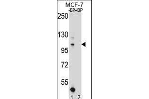 HIPK1 Antikörper  (C-Term)