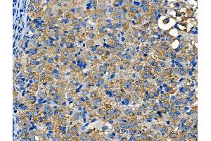 ABIN6260501 and ABIN6268729 at 1/100 staining Rat ovarian tissue by IHC-P. (Cathepsin E Antikörper  (Internal Region))