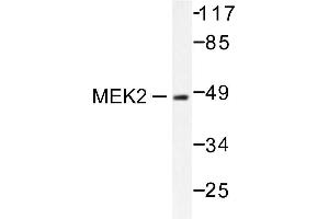 Image no. 1 for anti-Mitogen-Activated Protein Kinase Kinase 2 (MAP2K2) antibody (ABIN265519) (MEK2 Antikörper)