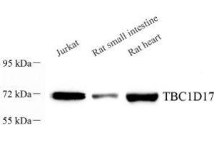 Western blot analysis of TBC1D17 (ABIN7075844) at dilution of 1: 1000