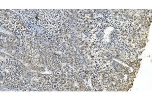IHC analysis of eRF1/ETF1 using anti-eRF1/ETF1 antibody (ABIN7602625). (ETF1 Antikörper  (AA 9-342))
