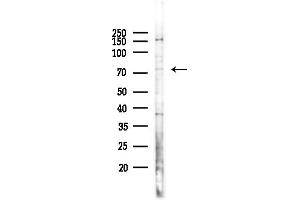 Western blot analysis of lysates from Hela cells(heat-shock,45 min treatment), using PIAS1 Antibody at 1/1000 dilution.