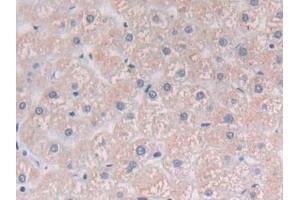 Detection of PLCg1 in Human Liver Tissue using Polyclonal Antibody to Phospholipase C Gamma 1 (PLCg1) (Phospholipase C gamma 1 Antikörper  (AA 1091-1290))