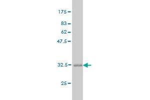 Western Blotting (WB) image for anti-Asparagine-Linked Glycosylation 12, alpha-1,6-Mannosyltransferase Homolog (ALG12) (AA 369-425) antibody (ABIN566339)
