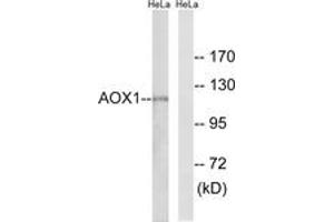 Western blot analysis of extracts from HeLa cells, using AOX1 Antibody. (AOX1 Antikörper  (AA 521-570))