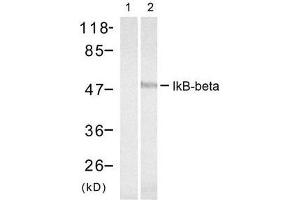 Western blot analysis of extract from 293 cells treated with TNF-α, using IκB-β (Ab-23) antibody (E021304, Lane 1 and 2). (NFKBIB Antikörper)