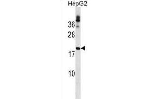 Western Blotting (WB) image for anti-Lipoma HMGIC Fusion Partner (LHFP) antibody (ABIN2999873) (LHFP Antikörper)