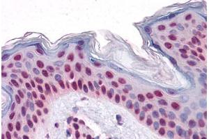 Immunohistochemistry (Formalin-fixed Paraffin-embedded Sections) (IHC (fp)) image for anti-TAR DNA Binding Protein (TARDBP) (AA 1-261) antibody (ABIN574446)