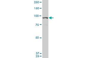 KIAA1201 polyclonal antibody (A01), Lot # 050914JCO1 Western Blot analysis of GRAMD1B expression in HepG2 . (GRAMD1B Antikörper  (AA 250-353))