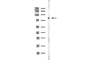 anti-Eukaryotic Elongation Factor-2 Kinase (EEF2K) (Internal Region) antibody