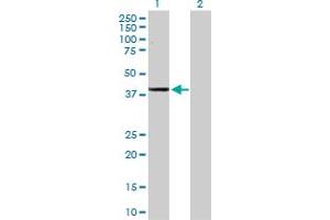 Western Blot analysis of ADH1C expression in transfected 293T cell line by ADH1C MaxPab polyclonal antibody.