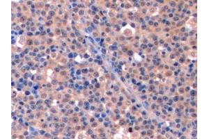 Immunohistochemistry (IHC) image for anti-Thymidylate Synthetase (TYMS) (AA 36-313) antibody (ABIN7436399)