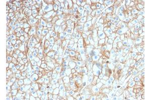 ABIN6383847 to PD-L1 was successfully used to stain membranes of carcinomas in human lung, cervex and breast sections. (PD-L1 Antikörper  (Extracellular Domain))