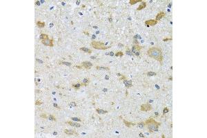 Immunohistochemistry of paraffin-embedded mouse spinal cord using CCT4 antibody. (CCT4 Antikörper  (AA 130-390))