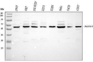 Western blot analysis of NOX4 using anti-NOX4 antibody (ABIN5692899). (NADPH Oxidase 4 Antikörper)