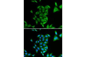 Immunofluorescence analysis of U2OS cells using PHYH antibody (ABIN5973726). (PHYH Antikörper)