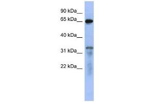 RAP1GAP antibody used at 1 ug/ml to detect target protein.