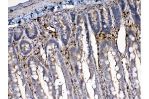 Immunohistochemistry (IHC) image for anti-Cytoglobin (CYGB) (AA 1-190) antibody (ABIN5518753)
