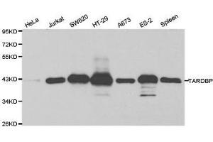 Western Blotting (WB) image for anti-TAR DNA Binding Protein (TARDBP) antibody (ABIN1875022) (TARDBP Antikörper)