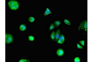 Immunofluorescent analysis of MCF-7 cells using ABIN7153311 at dilution of 1:100 and Alexa Fluor 488-congugated AffiniPure Goat Anti-Rabbit IgG(H+L) (Mesothelin Antikörper  (AA 1-62))