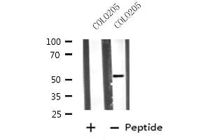 Western blot analysis of extracts from COLO205 cells, using VRK3 antibody. (VRK3 Antikörper  (Internal Region))