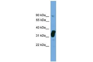 WB Suggested Anti-NOSIP Antibody Titration: 0. (NOSIP Antikörper  (Middle Region))