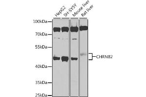 Western blot analysis of extracts of various cell lines, using CHRNB2 antibody (ABIN6131327, ABIN6138590, ABIN6138592 and ABIN6225110) at 1:1000 dilution. (CHRNB2 Antikörper  (AA 340-430))