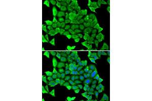 Immunofluorescence analysis of U2OS cells using MYH1 antibody. (MYH1 Antikörper  (AA 1-100))