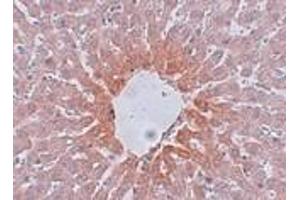 Immunohistochemistry (Paraffin-embedded Sections) (IHC (p)) image for anti-Angiotensin II Receptor, Type 2 (AGTR2) (Center) antibody (ABIN499231)