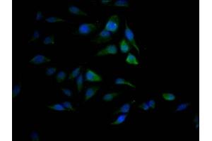 Immunofluorescence staining of Hela Cells with ABIN7127802 at 1:50, counter-stained with DAPI. (Rekombinanter SAE1 Antikörper)