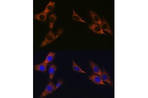 Immunofluorescence (IF) image for anti-Junction Plakoglobin (JUP) antibody (ABIN1683043)