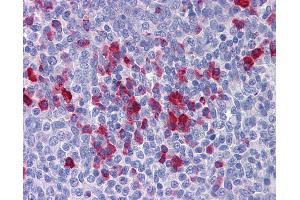 Immunohistochemistry (IHC) image for anti-Adaptor Protein, phosphotyrosine Interaction, PH Domain and Leucine Zipper Containing 1 (APPL1) (AA 467-516) antibody (ABIN6747166)