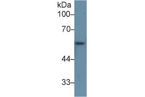 Western Blot; Sample: Rat Skin lysate; Primary Ab: 1µg/ml Rabbit Anti-Human KRT6A Antibody Second Ab: 0. (KRT6A Antikörper  (AA 163-468))