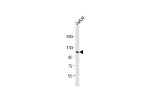 Anti-PRDM16 Antibody (Center) at 1:2000 dilution + Jurkat whole cell lysate Lysates/proteins at 20 μg per lane. (PRDM16 Antikörper  (AA 771-804))