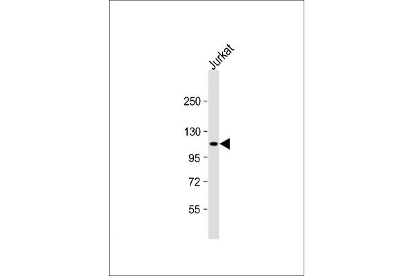 PRDM16 Antikörper  (AA 771-804)
