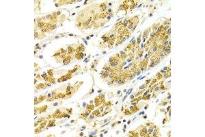 Immunohistochemistry of paraffin-embedded Human gastric using ATP6AP1 antibody at dilution of 1:100 (x400 lens). (ATP6AP1 Antikörper  (AA 90-390))