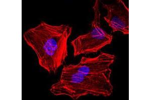 Immunofluorescence analysis of HeLa cells. (Cytokeratin 5 Antikörper)