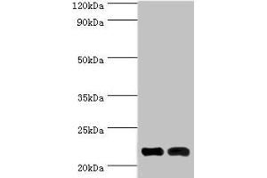 Western blot All lanes: Neuronal calcium sensor 1 antibody at 10 μg/mL Lane 1: Hela whole cell lysate Lane 2: Rat kidney tissue Secondary Goat polyclonal to rabbit IgG at 1/10000 dilution Predicted band size: 22, 20 kDa Observed band size: 22 kDa (NCS1 Antikörper  (AA 1-190))
