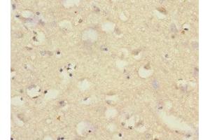 Immunohistochemistry of paraffin-embedded human brain tissue using ABIN7170966 at dilution of 1:100 (SAE1 Antikörper  (AA 1-346))