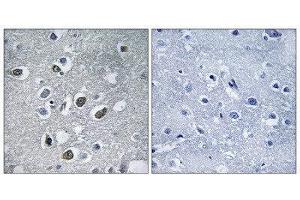 Immunohistochemistry (IHC) image for anti-Membrane-Associated Ring Finger (C3HC4) 4, E3 Ubiquitin Protein Ligase (MARCH4) (C-Term) antibody (ABIN1851269) (MARCH4 Antikörper  (C-Term))