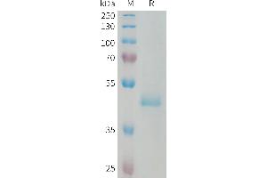 SDS-PAGE (SDS) image for Prolactin-Induced Protein (PIP) (AA 29-146) protein (Fc Tag) (ABIN7538487)