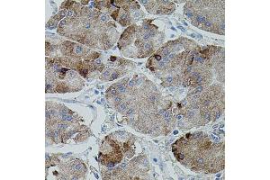 Immunohistochemistry of paraffin-embedded human stomach using APP antibody. (beta Amyloid Antikörper)