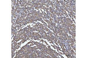 IHC analysis of MIM/MTSS1 using anti-MIM/MTSS1 antibody (ABIN7600276).