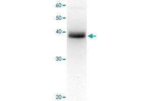 Detection of XPA protein in crude extract of HeLa cell by western blotting, using XPA monoclonal antibody, clone 5F12 . (XPA Antikörper)