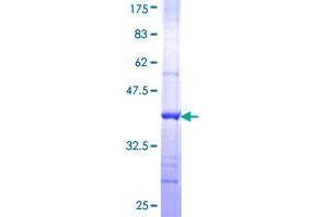 GCN2 Protein (AA 1401-1500) (GST tag)