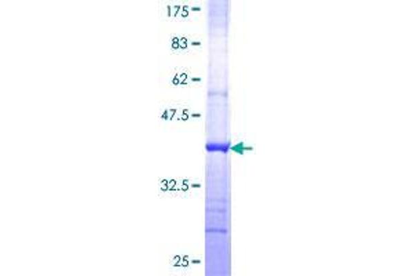 GCN2 Protein (AA 1401-1500) (GST tag)