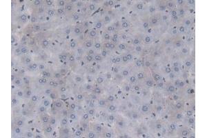 Detection of F2 in Rat Liver Tissue using Monoclonal Antibody to Coagulation Factor II (F2) (Prothrombin Antikörper  (AA 201-323))
