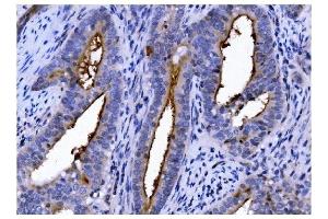 IHC analysis of CD13/ANPEP using anti-CD13/ANPEP antibody (ABIN7600088).
