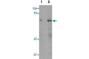 Western blot analysis of human skeletal muscle tissue with RANBP10 polyclonal antibody  at (Lane 1) 1 and (Lane 2) 2 ug/mL dilution. (RANBP10 Antikörper  (Internal Region))